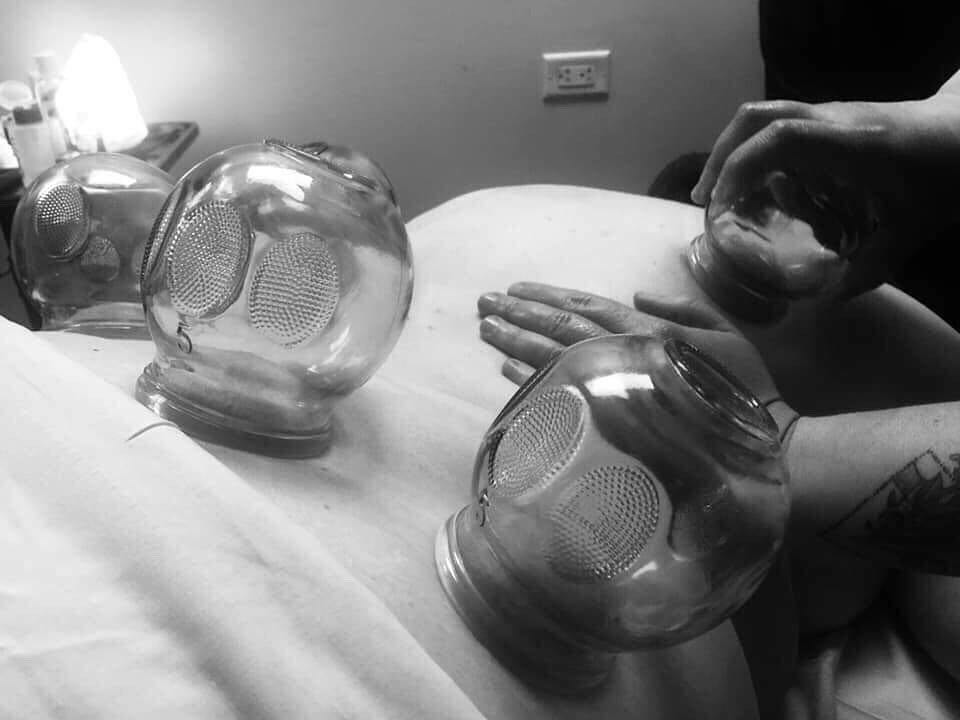 Practicing fire cupping.